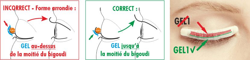 Application correcte du GEL - Bild